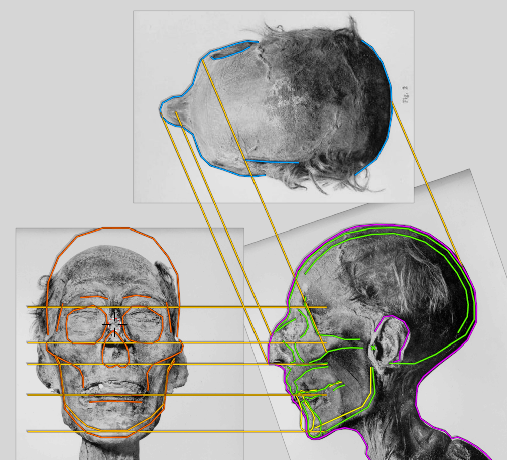 _images/RII_skull_projections.png